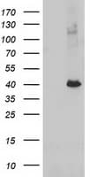 ADH2 / ADH1B Antibody (clone OTI1C3)