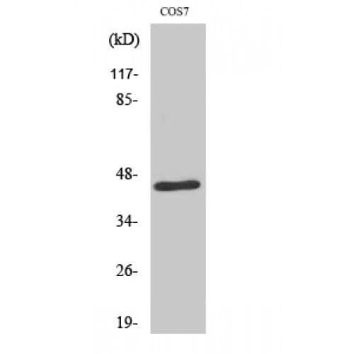 E2F4/E2F5 Antibody (30-110 aa, Internal)