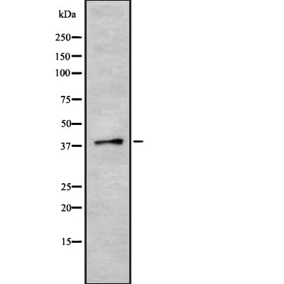 SRSF6 / SRP55 Antibody