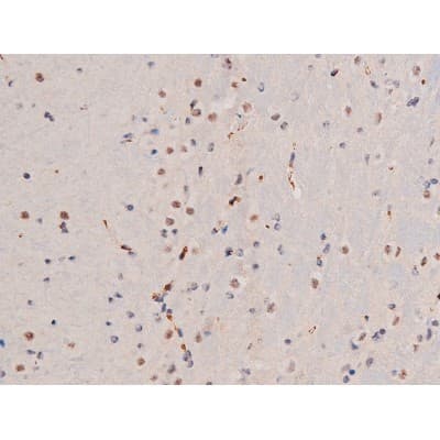 ADD1 / Adducin Alpha Antibody (phospho-Ser726)