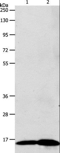 LHB / Luteinizing Hormone Antibody