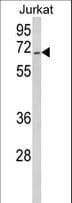 Polyclonal Rabbit anti-Human COAA / RBM14 Antibody (aa193-223, IHC, WB)