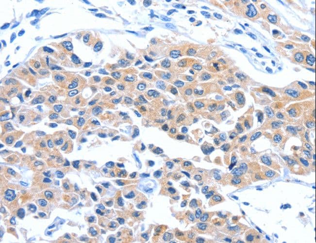 Polyclonal Rabbit anti-Human ARL11 Antibody (IHC)