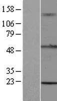 TRIM15 Protein (Over-Expression Lysate Myc-DDK (Flag))