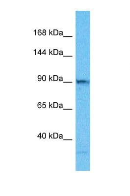 Polyclonal Rabbit anti-Human TELO2 Antibody (C-Terminus, WB)