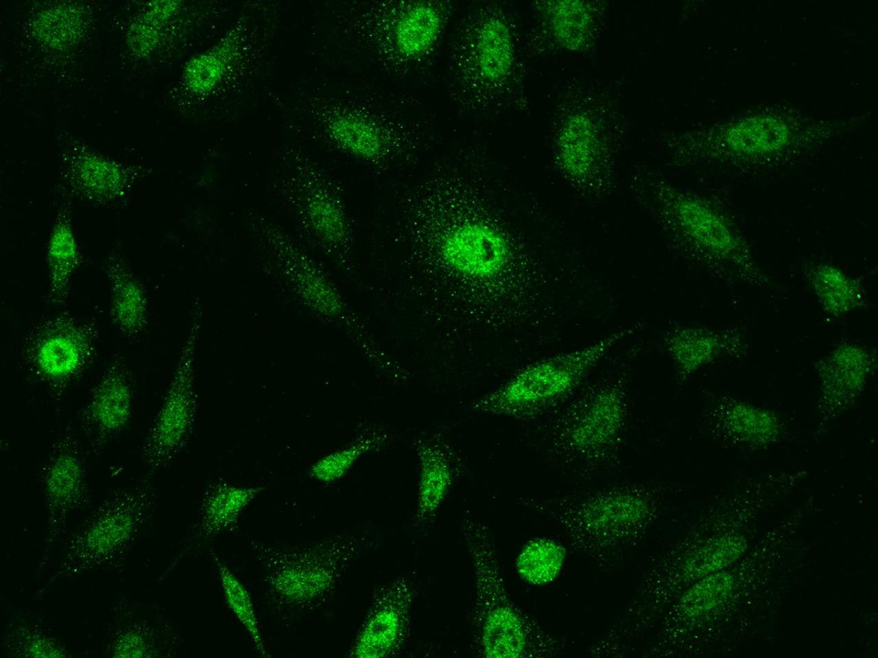 SF3B4 Antibody