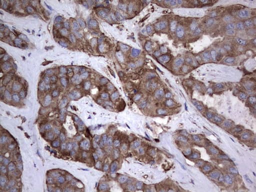 PKM2 Antibody (clone 14C7)
