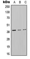 Polyclonal Rabbit anti-Human MT-ND2 Antibody (Internal, WB)