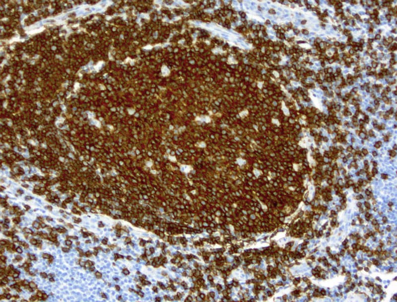 CD19 Antibody (clone UMAB103)