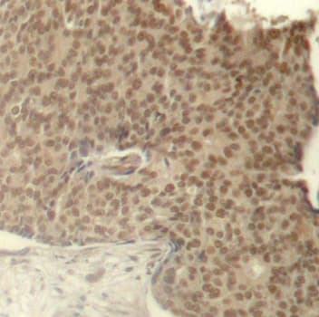 HDAC2 Antibody (phospho-Ser394)