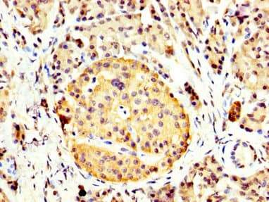 CCKBR / Cckb Antibody