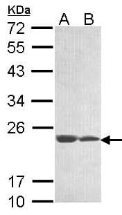 C11orf85 Antibody (aa1-206)