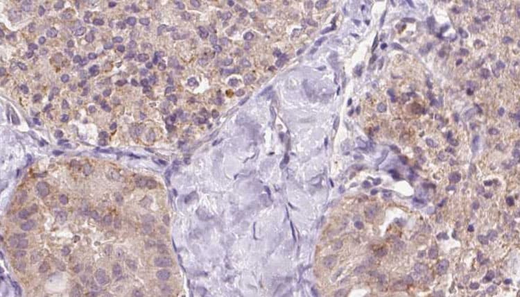 Polyclonal Rabbit anti-Human ZFYVE27 / Protrudin Antibody (IHC, WB)