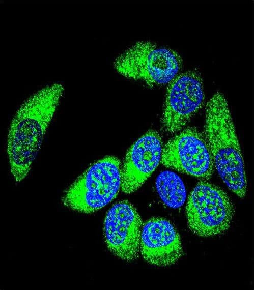 WT1 / Wilms Tumor 1 Antibody (aa346-375)