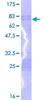 Human PBX2 Protein (Recombinant GST)