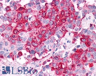 PathPlus™ GPR34 Antibody (C-Terminus)