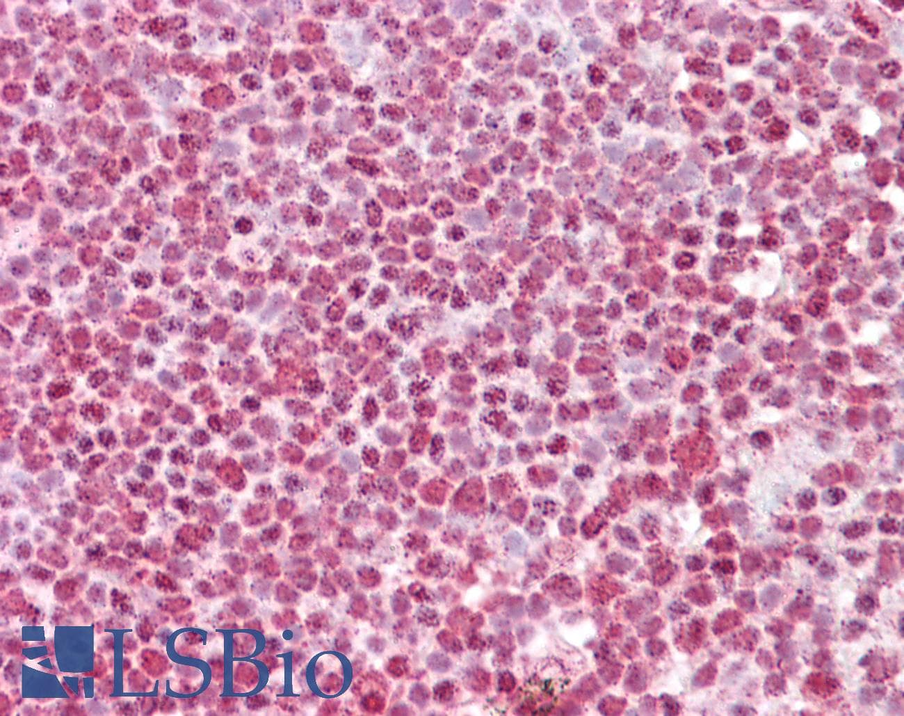 IHC-plus™ Polyclonal Goat anti-Human FBXO4 / FBX4 Antibody (aa250-262, IHC)