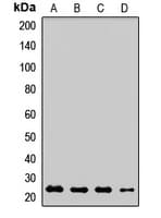 Polyclonal Rabbit anti-Human RAB18 Antibody (WB)