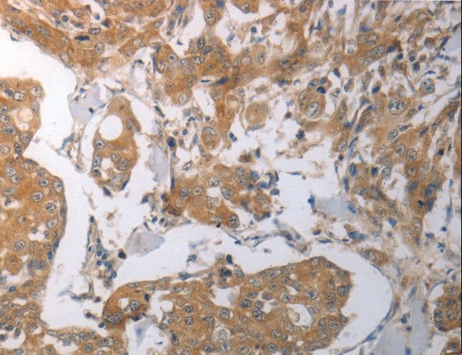 SHH / Sonic Hedgehog Antibody