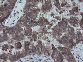 Monoclonal Mouse anti-Human SKIL / SNO / SnoN Antibody (clone OTI3E2, IHC, WB)