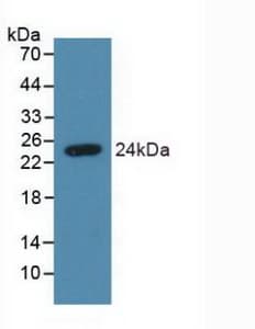 SDC4 / Syndecan 4 Antibody (aa18-145)