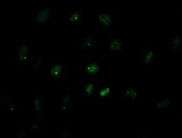 Monoclonal Mouse anti-Human GATA4 Antibody (clone OTI9F9, IHC, IF, WB)