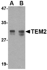 IHC-plus™ RASD2 Antibody