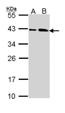 Polyclonal Rabbit anti-Human SAE1 Antibody (aa3-247, IHC, WB)