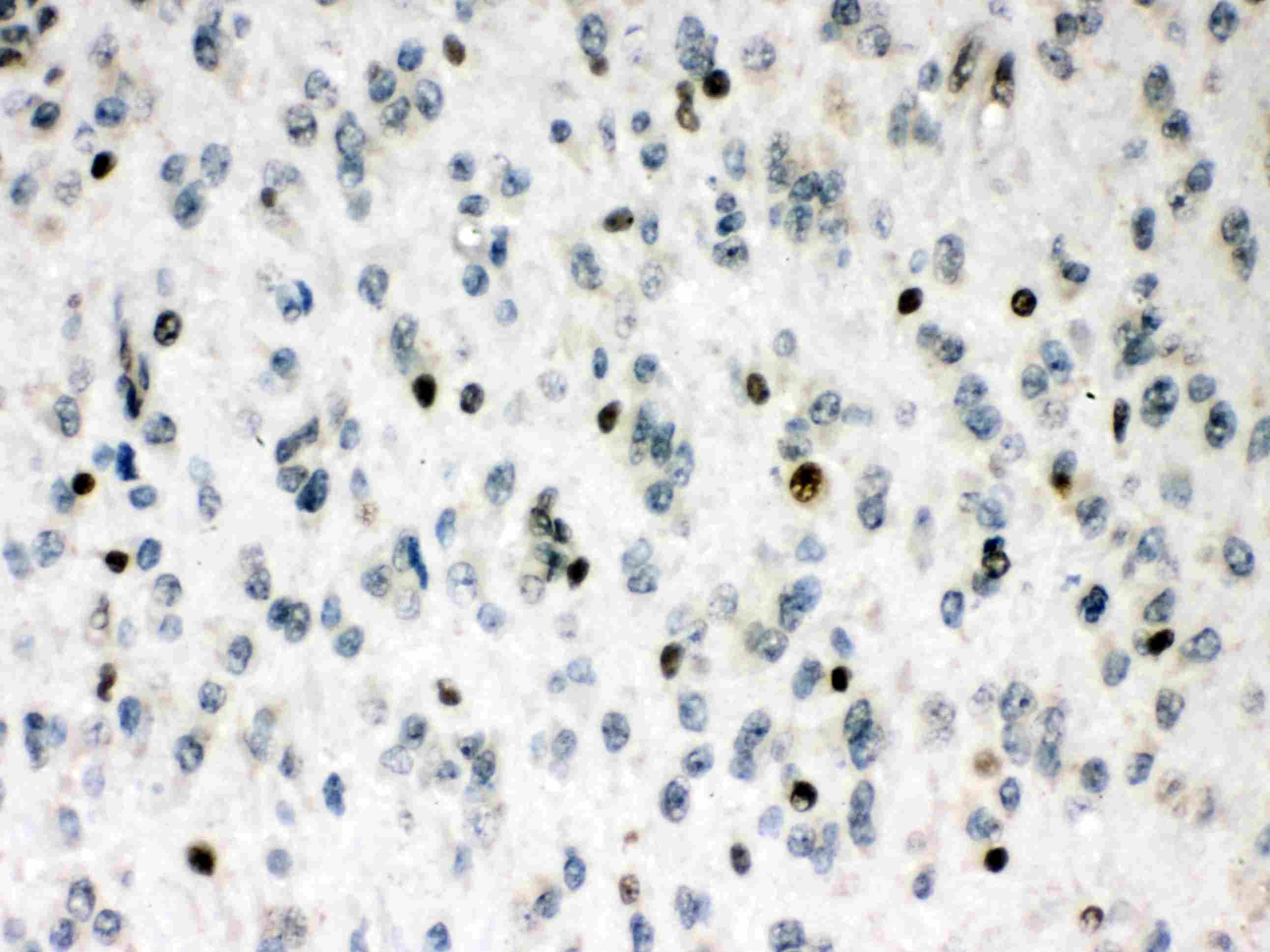 MEF2A / MEF2 Antibody