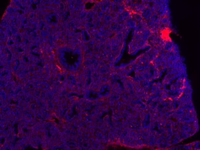 Monoclonal Mouse anti-Human EPHB3 / EPH Receptor B3 Antibody (clone 4A122D1, Amino Acid: 39-212, IHC, WB)