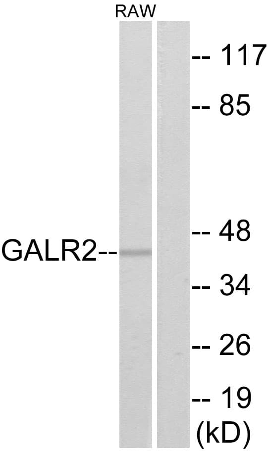 GALR2 / Galanin Receptor 2 Antibody (aa201-250)