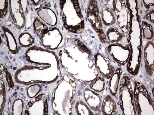 KRT7 / CK7 / Cytokeratin 7 Antibody (clone OTI3E5)