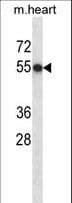 CSNK1D Antibody (aa204-231)