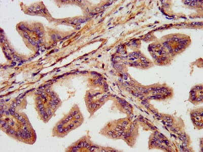 Polyclonal Rabbit anti-Human TNKS1BP1 / TAB182 Antibody (IHC, IF)