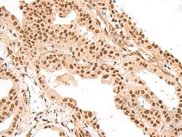 Polyclonal Rabbit anti-Human GAL4 / Galectin 4 Antibody (IHC, WB)