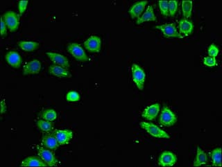 ANXA10 / Annexin A10 Antibody