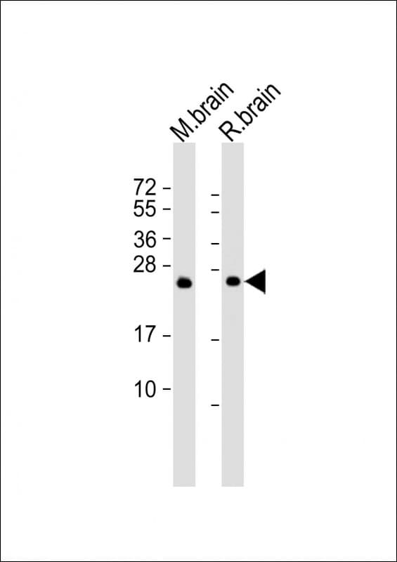 IHC-plus™ RAB3A Antibody (clone 1531CT562.14.57)
