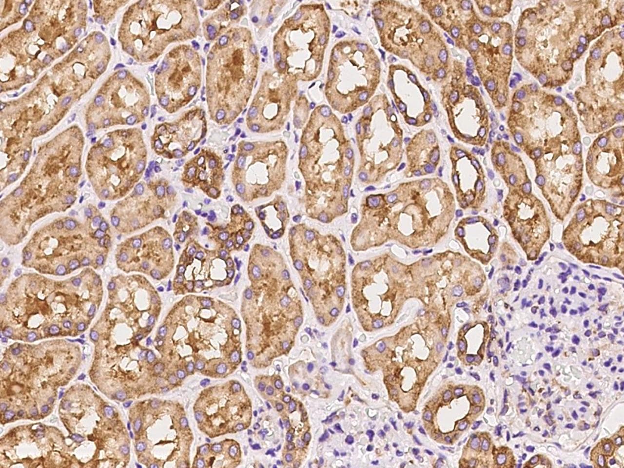 FARSA Antibody