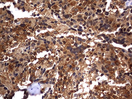 CSNK1G2 / CKI-Gamma 2 Antibody (aa163-415, clone OTI4H3)
