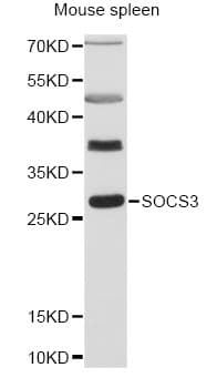 SOCS3 Antibody
