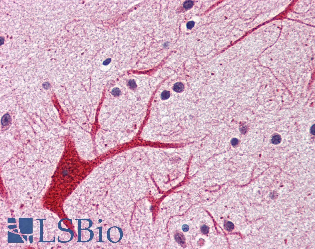 IHC-plus™ CHUK / IKKA / IKK Alpha Antibody (C-Terminus)
