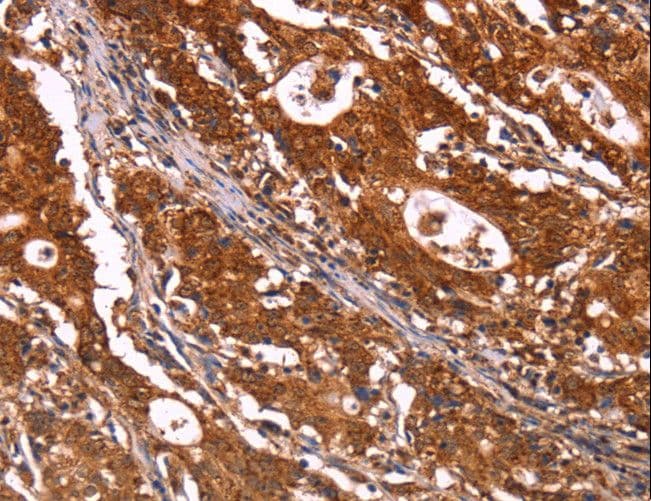 Polyclonal Rabbit anti-Human ABI1 / SSH3BP1 Antibody (IHC, WB)