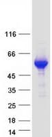 Human KDM8 / JMJD5 / FLJ13798 Protein (Recombinant Myc-DDK (Flag))