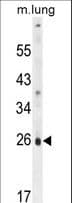 PQLC1 Antibody (aa100-128)