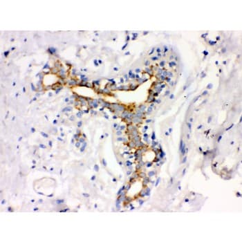 Polyclonal Rabbit anti-Human ATXN2 / SCA2 / Ataxin-2 Antibody (aa1283-1313, IHC, WB)