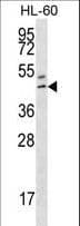 Polyclonal Rabbit anti-Human HOXB3 Antibody (aa119-148, IHC, WB)