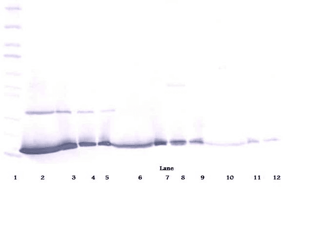 IHC-plus™ IFN Gamma / Interferon Gamma Antibody