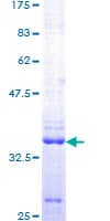 Human UHRF1 Protein (Recombinant GST, N-terminus)
