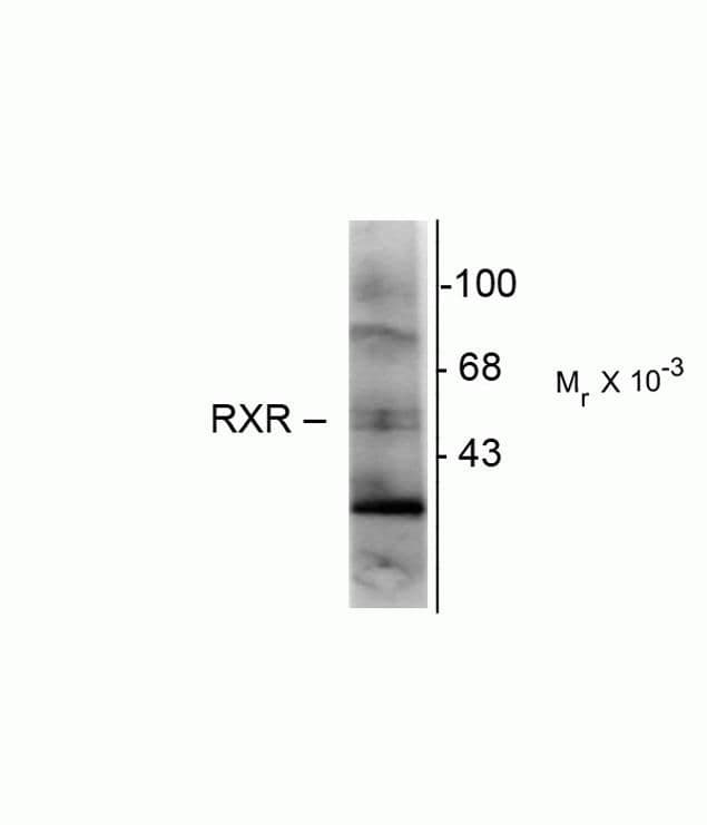 RXRG Antibody (clone 1373)