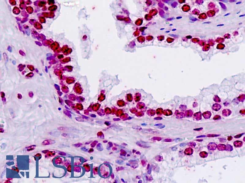 IHC-plus™ TSHZ2 Antibody (aa232-261)